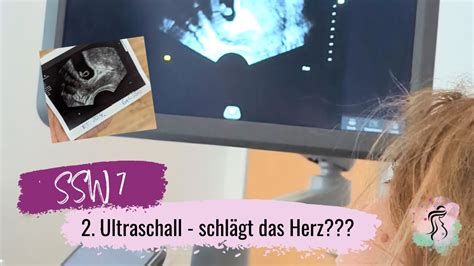 Ultraschallbild von Shay Mitchells Fehlgeburt