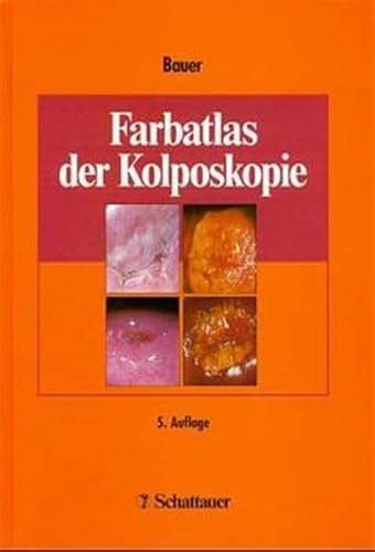 Schema der Kolposkopie mit Vergrößerung des Gebärmutterhalses