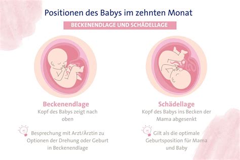 Grafik, die die Beckenendlage eines Babys zeigt