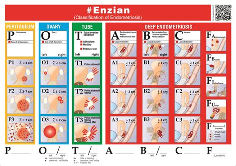 Schema des Endometriose-Klassifikationsmodells «ENZIAN» mit Darstellung von Grösse, Tiefe und Lage der Läsionen.