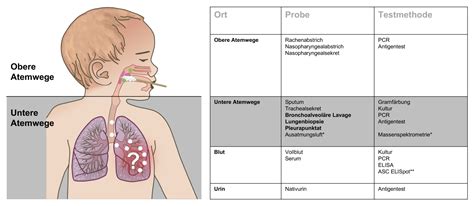 Schema zur Unterstützung der Trinkfähigkeit bei Frühgeborenen durch physiotherapeutische Maßnahmen