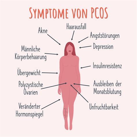 Schema der hormonellen Dysregulation bei PCOS mit Fokus auf Insulinresistenz und übermäßiger Androgenproduktion