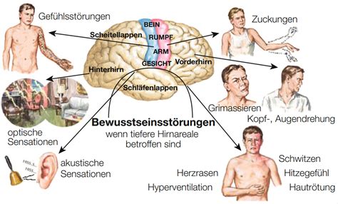 Schema, das die Risikofaktoren von Epilepsie in der Schwangerschaft darstellt