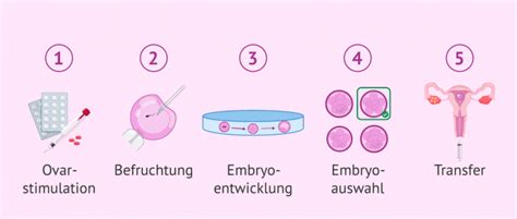 Grafik, die den Prozess der In-vitro-Fertilisation (IVF) veranschaulicht