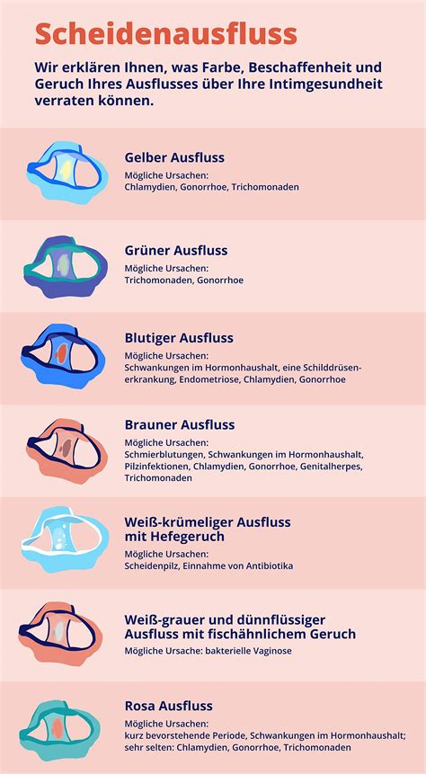 Infografik, die verschiedene Farben und Konsistenzen von vaginalem Ausfluss darstellt und auf mögliche Ursachen hinweist