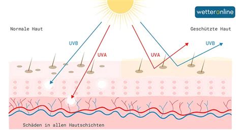 Schema der phototoxischen Reaktion: Pflanzensaft auf der Haut + UV-Strahlung führt zu Hautschäden.