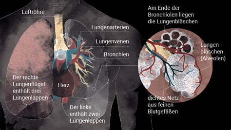Ultraschallbild einer Lunge mit zystischen Veränderungen