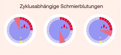 Infografik, die verschiedene Ursachen für Schmierblutungen visualisiert (hormonell, organisch, mechanisch).