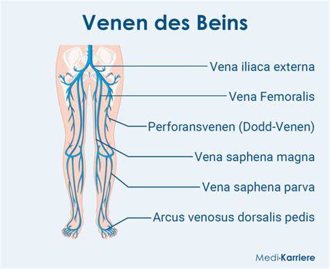 Schema der Anatomie des Anus mit oberflächlichen Venen und möglichen Thrombosebildungen