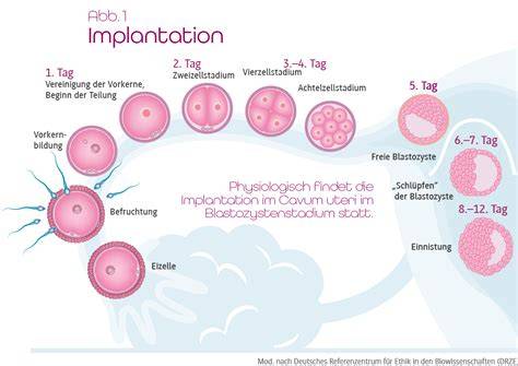 Schema zur Darstellung verschiedener Erfolgsraten in der Reproduktionsmedizin
