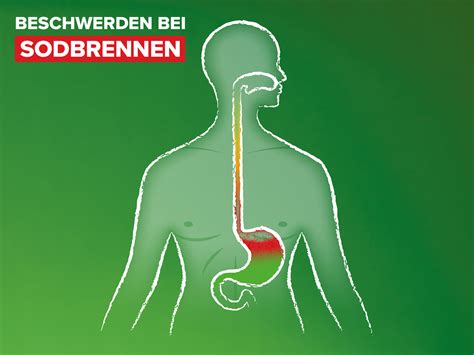 Illustration, die verschiedene Schwangerschaftsbeschwerden wie Sodbrennen und Rückenschmerzen darstellt.