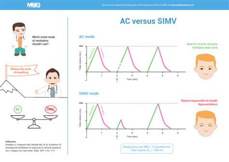 Vergleich verschiedener Beatmungsmodi (SIMV, AC, V/C, HFOV) für Neugeborene, mit ihren jeweiligen Anwendungsbereichen und Parametern.
