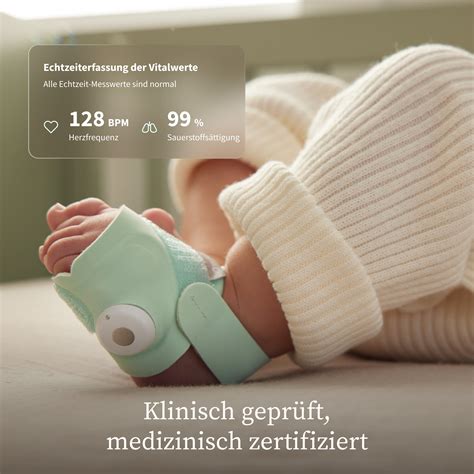 Illustration einer Owlet Smart Sock an einem Babyfuß