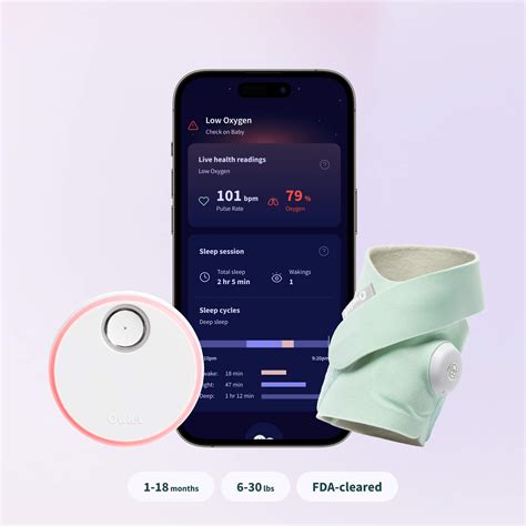 Infografik mit Gegenüberstellung von Vor- und Nachteilen der Owlet Smart Sock