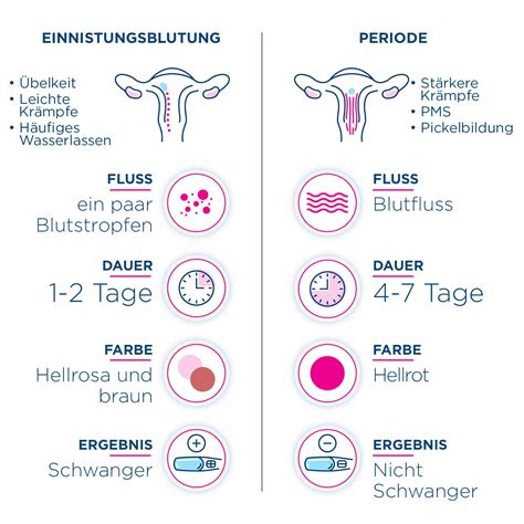 Vergleichstabelle: Einnistungsblutung vs. frühe Periode vs. Eisprungblutung