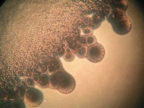 Mikroskopische Aufnahme von Candida albicans