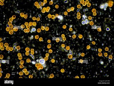 Mikroskopische Aufnahme von Gewebeproben in der Pathologie