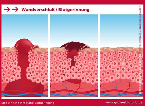 Schema zur Erstversorgung bei Zahnunfällen mit Fokus auf Blutstillung und Kühlung