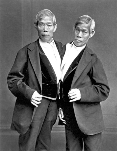 Historische Abbildung von Chang und Eng Bunker