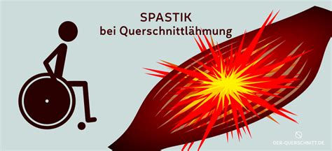 Schema, das die typischen Bewegungen bei infantilen Spasmen zeigt