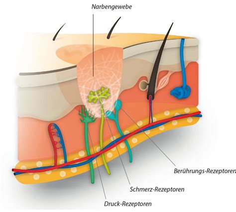 Illustrationsschema der Narbenbildung und ihrer Auswirkungen auf das Gewebe