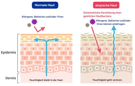 Vergleich von gesunder Hautstruktur und Narbengewebe