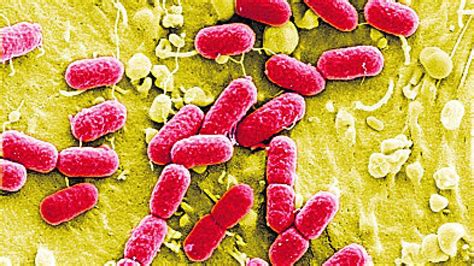 Mikroskopische Aufnahme von Campylobacter-Bakterien im Labor