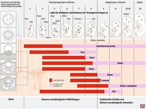 Eine schematische Darstellung des Fetus in fetu-Syndroms im menschlichen Körper.