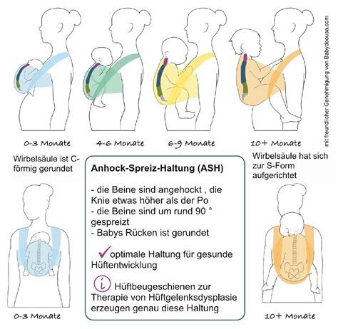 Infografik zur ergonomischen Haltung des Babys in einer Tragehilfe