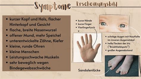 Schema zur frühkindlichen Förderung bei Down-Syndrom mit Fokus auf motorische und kognitive Entwicklung
