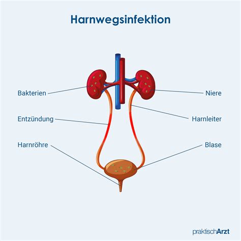 Grafik, die die Wirkungsweise von Brennnesseltee bei Harnwegsinfekten veranschaulicht (Durchspülung der Harnwege)