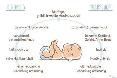 Infografik: Unterschiede zwischen Kopfgneis und Milchschorf