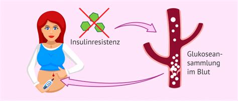 Illustration: Gegenüberstellung von typischen Schwangerschaftssymptomen und möglichen Symptomen von Schwangerschaftsdiabetes