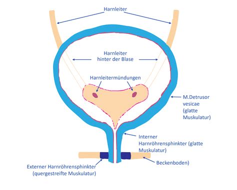 Abbildung 4: Eingewachsenes TVT-Band in der Blase.
