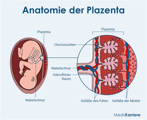 Schema der Gebärmutter mit Lage der Plazenta (Vorder- und Hinterwand)
