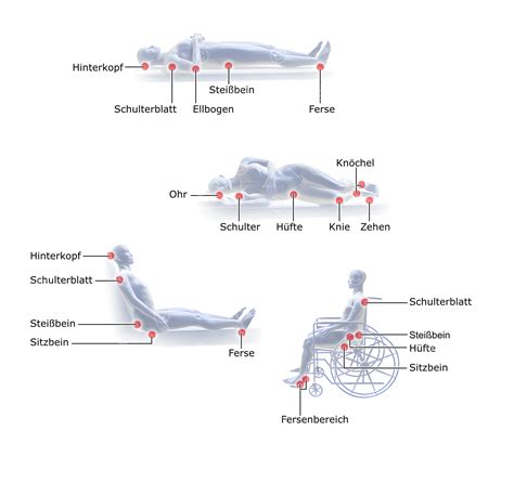 Illustration verschiedener Lagerungspositionen zur Vorbeugung von Kopfverformungen