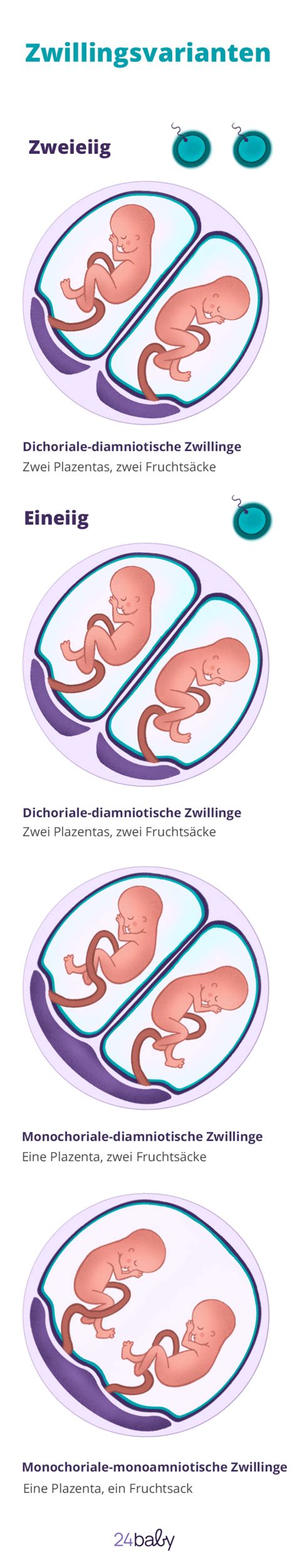 Infografik: Wahrscheinlichkeit der Zwillingsschwangerschaft und des Überlebens