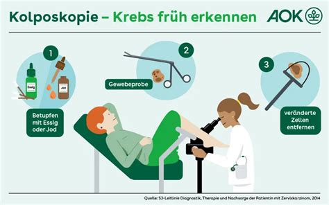 Schema einer Kolposkopie mit Kolposkop und Spekulum