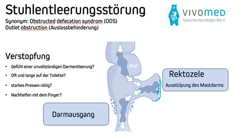 Schema der Reproduktionsmedizinischen Behandlungsmöglichkeiten
