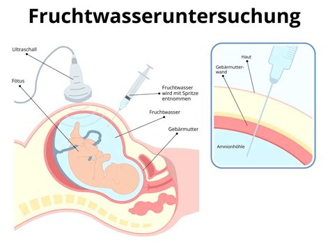 Illustration der Fruchtblase mit Fruchtwasser, das das Baby umgibt