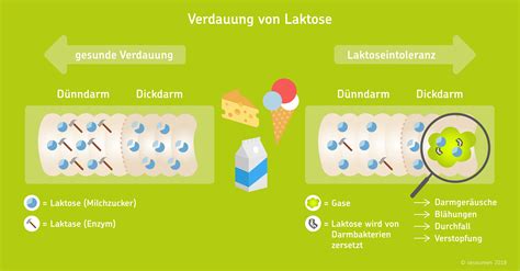 Grafik, die den Prozess der Laktoseverdauung und die Auswirkungen einer Laktoseintoleranz darstellt