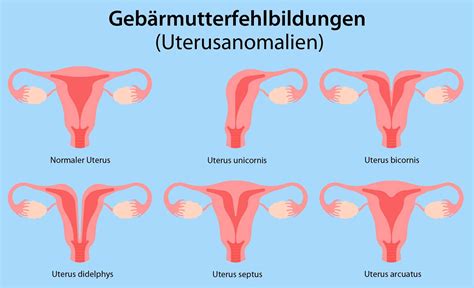 Grafik, die die Transformationszone am Gebärmutterhals und die Entnahme des Pap-Abstrichs zeigt