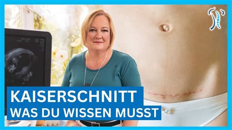 Darstellung einer defekten Kaiserschnittnarbe im Ultraschall