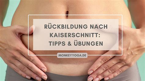 Infografik zur Unterstützung der Rückbildung nach einem Kaiserschnitt
