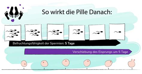Vergleich der Notfallverhütungsmethoden (Pille danach vs. Kupferkette)