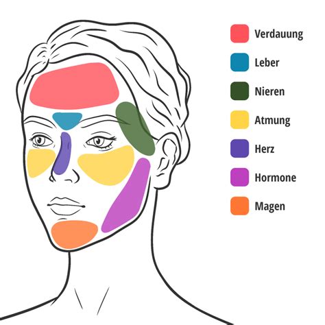 Illustration des typischen Masernausschlags, der im Gesicht beginnt