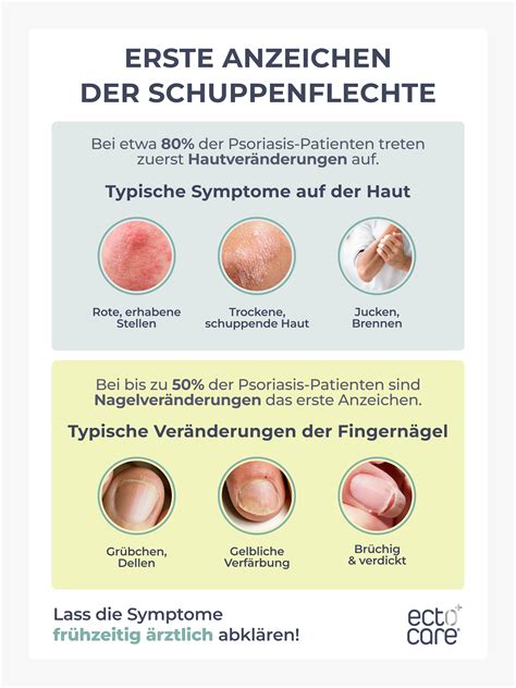 Schema mit den ersten Anzeichen von Schuppenflechte bei Babys: rote Flecken, Nagelveränderungen, Windelbereich
