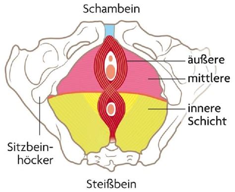 Illustration verschiedener Grade einer Beckenbodensenkung