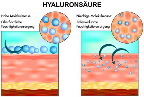 Schema: Wirkungsweise von Hyaluronsäure im PICSI-Verfahren und Zestica Gel