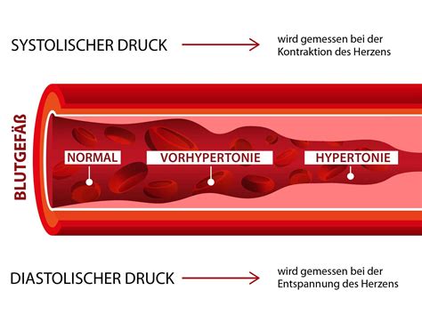Schematische Darstellung der Organe, die vom Bluthochdruck betroffen sein können (Herz, Nieren, Gehirn)